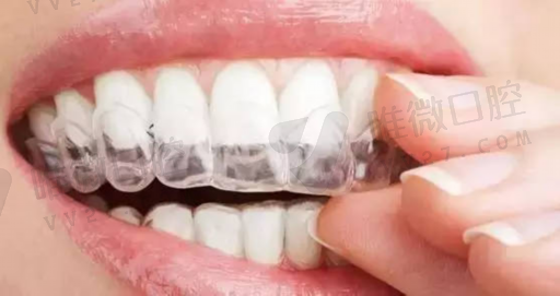 假牙用什么材料区别大小,假牙的牙龈是什么材料做的(图1)